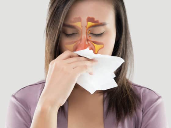 A woman with a sinus infection (sinusitis) blows her nose.