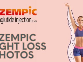 Ozempic Weight Loss Before And After Pictures