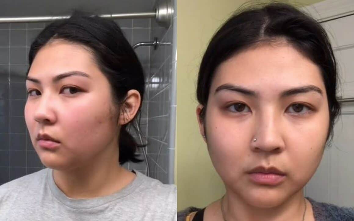 Gua Sha Before And After daily use for a month