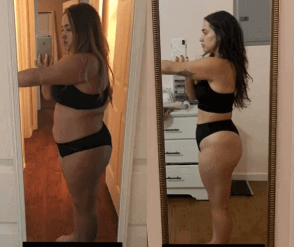 Ozempic Weight Loss Transformation 2